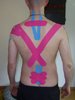 KinesioTaping