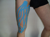 KinesioTaping