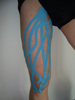 KinesioTaping